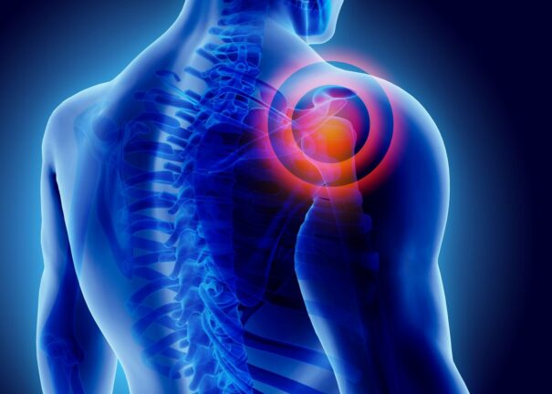 3D illustration of a human upper body with transparent skin showing the spine and shoulder joint highlighted in red, indicating shoulder pain or injury.
